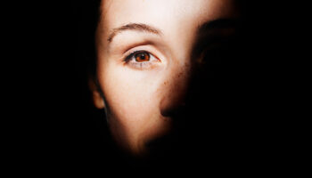 blog-image-melasma-large