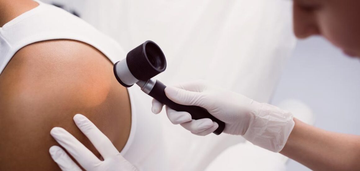 doctor examining a patient's back for skin cancer