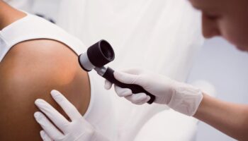 doctor examining a patient's back for skin cancer