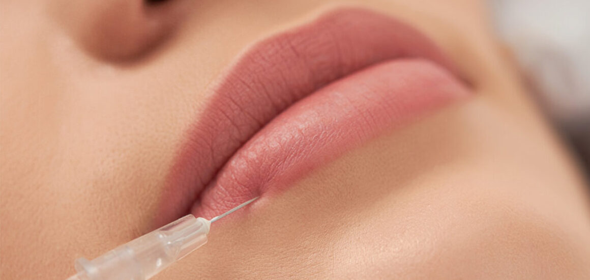 blog-image-lip-injections