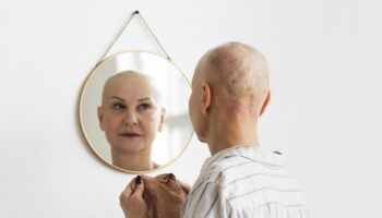 blog-image-alopecia-social