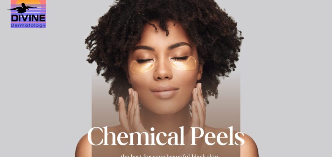 chemical peel black skin