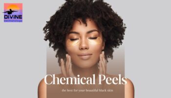 chemical peel black skin