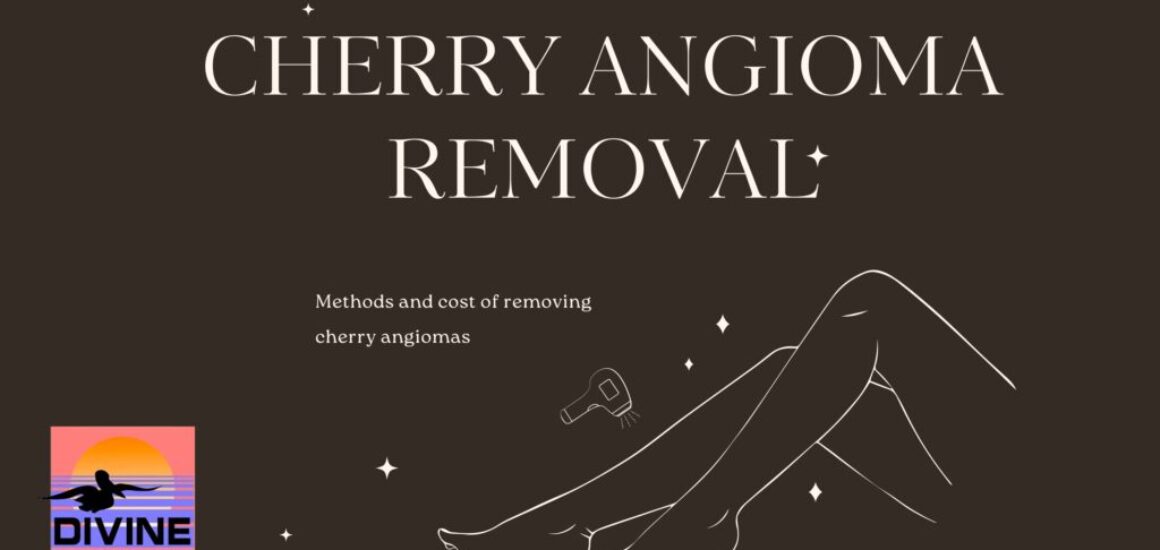 cherry angioma removal