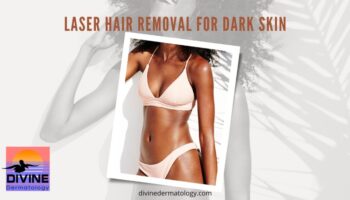 laser hair removal for black skin laser hair removal for dark skin