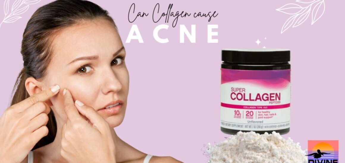 can collagen cause acne and symptoms of too much collagen