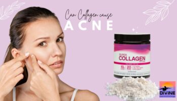 can collagen cause acne and symptoms of too much collagen