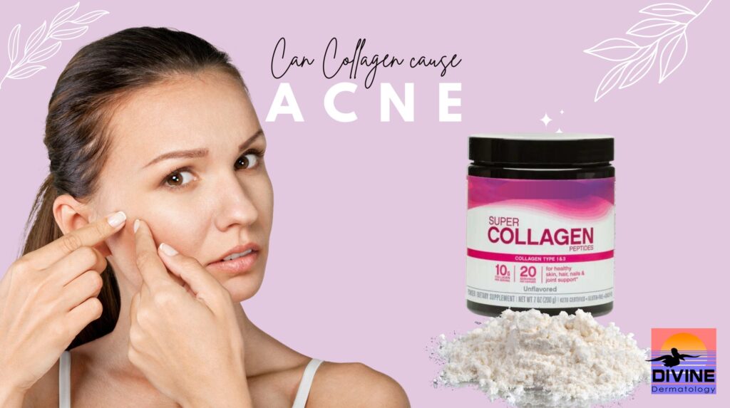 Can Collagen Cause Acne? | Divine Dermatology