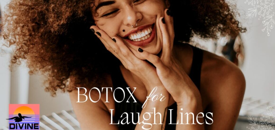 botox for laugh lines