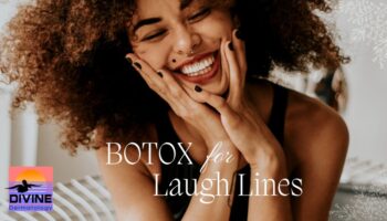 botox for laugh lines