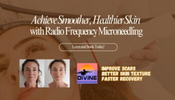 radio frequency microneedling, radio frequency microneedling near me, benefits of radio frequency microneedling