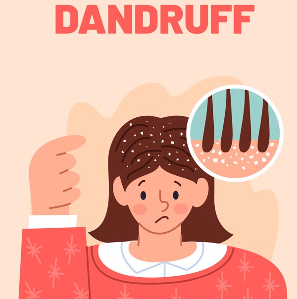 dandruff-graphic