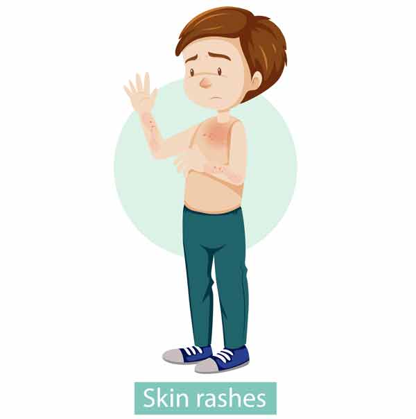 dermatitis-graphic dermatitis-graphic
